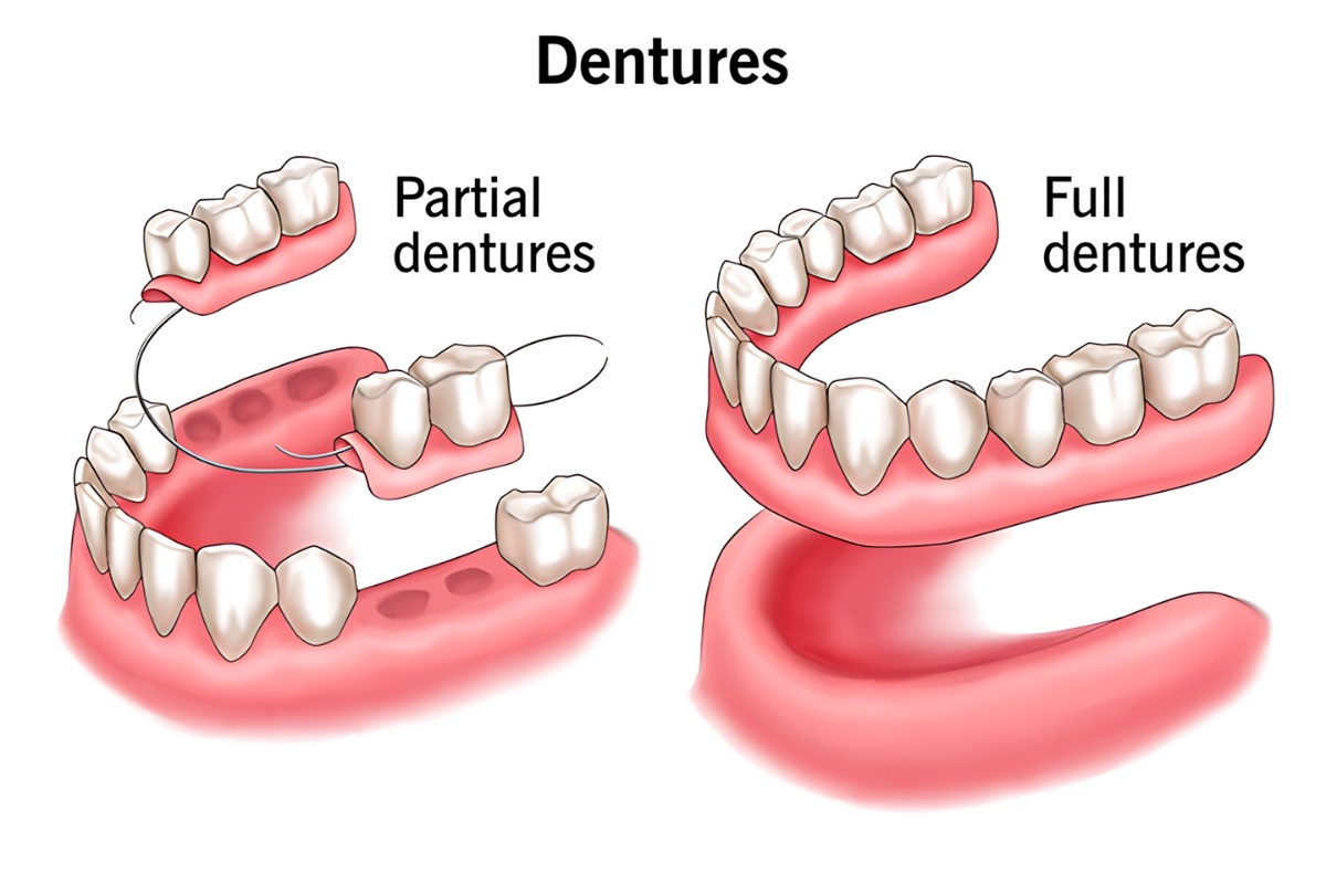 denture